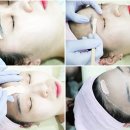 참피부미용