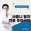웅상 바룸 치과의원 | 웅상바룸치과에서 알려드리는 &#39;사랑니 발치 전후 주의사항&#39;
