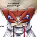 ＜1주차 복습자료＞ 두통근육, 상위경추의 과신전근육, 죽음의 언덕이라고 불리는 근육.. 후두하근을 주목하자..!!! 이미지