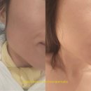 덕용프라자 | [공지] 인천계산동역세권 작전역피부관리 탐날에스테틱 물톡스필링피부관리후기