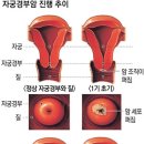 인달 이미지