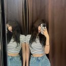 색소침착레이저 / 종아리살빼기 케어받은 후기