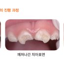 동래도담소아치과의원 네이버블로그