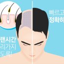 흥미헤어라인 이미지