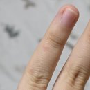 티지소프트 | 팥도너츠와 모기 그리고 포모도로 세바스찬 2세