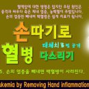 백혈병을 손 따기로 완치하는 방법 이미지