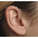 종로 보청기 이미지