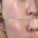 스킨케어 뷰티디바이스 추천, 산소테라피 미스트 에버벤 아쿠아슈팅으로 속건조·속보습 해결방법 리얼후기
