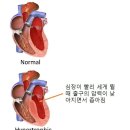 안전한 마라톤을 위한 응급의학과 의사의생각° 이미지