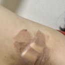 이창우외과의원 | 종기와 함께하는 일상…ㅎ