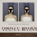 머리 작아지는 법 콘헤드 두상까지 해결하는 방법