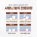 대곶치과의원 네이버블로그