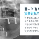 플란치과기공소 이미지