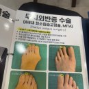 한성당필방 | #107. 무지외반증 그게 뭔데
