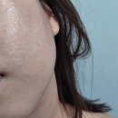 박관식내과의원 | [부산 피부관리] 수분충전 지니에스테틱 대만족 후기