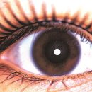 밝은안과의원 이미지