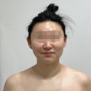 고운피부샾 | 서산 피부관리 고운피부에스테틱 여드름관리 받고 온 후기