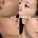 아나 피부샵 | [청주 봉명동 피부관리샵 추천] '피아나뷰티랩'에서 수분 폭탄 맞은 후기 ! (신부관리 수분관리 웨딩...