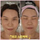 하얀피부사랑 | 라끄 스킨케어에서 피부관리 받은 후기 #군산피부관리 #군산피부관리잘하는