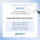 온양하나치과의원 네이버블로그