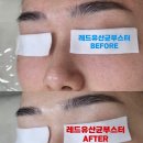늘미쁨스킨