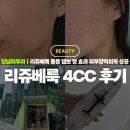 멍발란스 | 강남피부과 리쥬베룩 4cc 후기 통증 엠보 멍 효과 피부장벽회복 성공