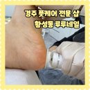 네일루루 | 경주 네일샵 풋케어 전문 내성발톱 발톱무좀 전문 큐릭스 루루네일