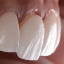 화이트디지털치과기공소 이미지