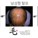 불로장생모