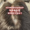 한올SMP | 순천헤어증모 리얼후기｜여우속눈썹 한올증모로 탈모 땜빵 고민 해결하고 자신감 회복!