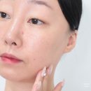 위드팜바른약국 | 트러블패치 추천 더마틱스 리페어 스팟패치 약국템