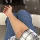 곽의원 | Jc빛소망안과 초고도근시+고도난시의 라섹 후기ㅣ필수 준비물ㅣ안약 알람 어플추천