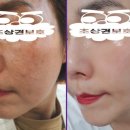 피부미인(인셀덤) 이미지