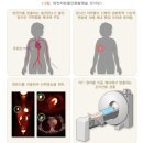 펫시티 | 및 전이 확인, 양전자방출단층촬영, 대학병원 펫시티 검사 후기, 가격, 결과, 진행과정, 주의사항, 장점...