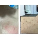 쇼킹바(Bar) 이미지