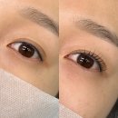 아이컬리티 네이버블로그
