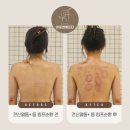 뷰스킨 숲칼프 안양 호계점 바디관리전문 에스테틱 등관리 헤드스파관리 열돔관리 체험 찐후기