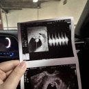 더펠리스 | 용인분당 산후조리원 투어 가격 비교부터 예약시기까지 알려드려요!