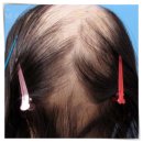 수북한의원 이미지