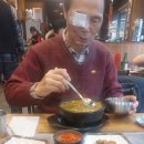 소천안과 | 노안 백내장수술 후기 비용 회복기간 통증 주의사항