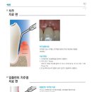 엔도위즈 이미지