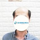 모아가발 네이버블로그