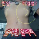 리바디짐 | 벌어진 갈비뼈 닫게하는법(feat.구미 체형교정 자세교정 도수치료 전문 리바디볼 운동센터)