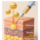 청담흰의원 | [청담 피부과] 줄기세포 피부주사 내돈내산 찐 후기