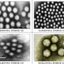 노로바이러스 전염 잠복기 굴노로바이러스(음식) 이미지