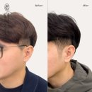 마이크로청담