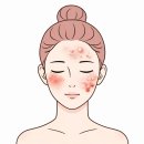 w-30 | 라시뎀 피토 엑소좀 AC-W 앰플 30ml 내돈내산 후기 | 트러블 특허성분 3% + 시카엑소좀 3% 솔직 리뷰