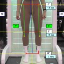 엑스바디 이미지