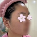 이다모드 | [홈모드]내돈내산 홈모드써마리프트 후기_Week4