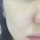 나이스엔투 이미지